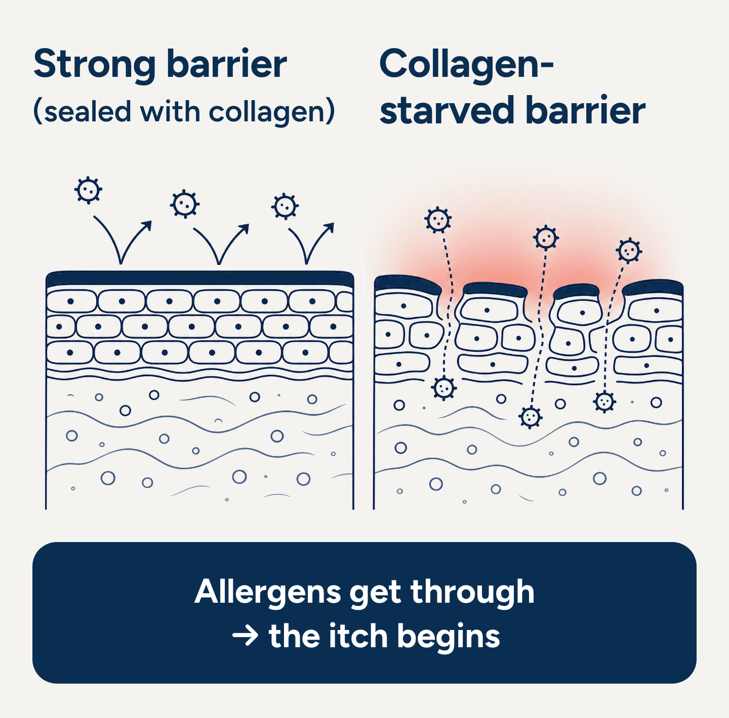 Cross-section diagram: a sealed skin barrier turning allergens away, beside a collagen-starved barrier letting them through